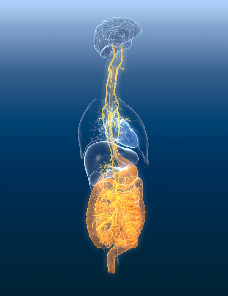 Vagus Nerve With Painul Stomach And Digestive System